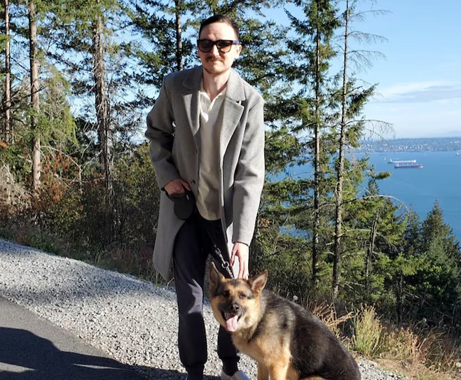 '골치아각막보철술'(OOKP)을 받은 브렌트 채프먼. 사진=브렌트 채프먼