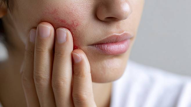 미세먼지는 피부 표면과 모공 주변에 달라붙어 가려움, 붉어짐 등 피부 문제를 일으킬 수 있다｜출처: 클립아트코리아