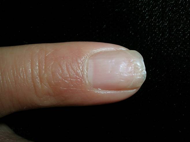 쉽게 부서지거나 갈라지는 손톱은 잦은 물 접촉이나 세제 사용, 노화가 흔한 원인이다./사진=클립아트코리아