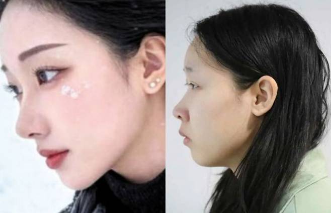 '강북 모텔 약물 사건' 피의자 김소영의 공개된 얼굴(오른쪽)과 그의 것으로 추정되는 SNS 계정 내 사진. SNS 캡처