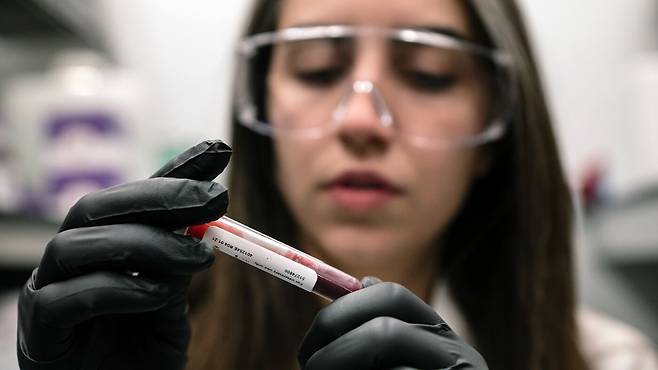 미국 글래드스톤 연구소의 욜란다 마르티-마테오스 박사가 혈액이 들어있는 시험관을 점검하고 있다. 글래스톤 연구소 과학자들은 적혈구가 저산소 환경에서 숨겨진 포도당 스펀지 역할을 한다는 사실을 발견했다./미 글래드스톤 연구소