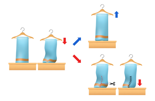 안면윤곽 후 볼처짐에 안면거상은, 옷걸이가 내려가서 수건이 바닥에 닿는데 수건을 잘라 꿰매는 상황입니다.
