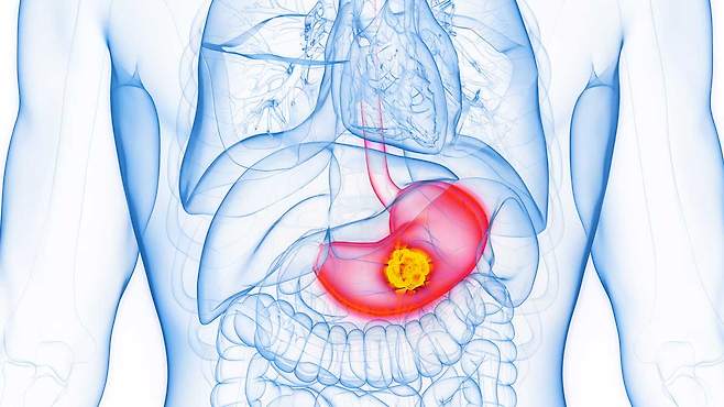 사진=클립아트코리아