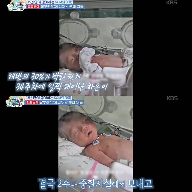 2주 가량을 중환자실에서 보낸 하온이. 유튜브 채널 'KBS Entertain' 영상 캡처