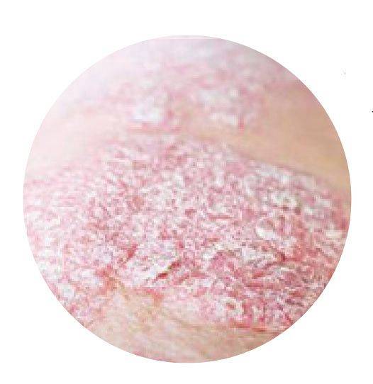 [사진 서울대병원]