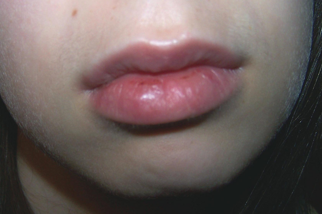 입술