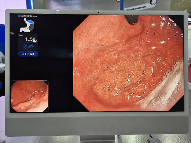웨이센 부스에는 이번에 업데이트 된 ‘웨이메드 엔도’가 의료진의 위 내시경을 보조하는 모습이 전시되고 있다. 이미 검진을 마친 부분, 검진 중인 부분, 아직 검진하지 않은 부분이 직관적으로 화면에 제시돼 자연스럽게 내시경 검사의 품질 개선을 돕는다. (사진=이데일리 나은경 기자)
