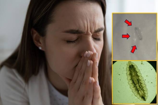 30대 여성의 코에서 특별한 유발 요인 없이 살아있는 유충이 발견된 드문 사례가 보고됐다. 배경사진=게티이미지뱅크/우측 사진=큐레우스