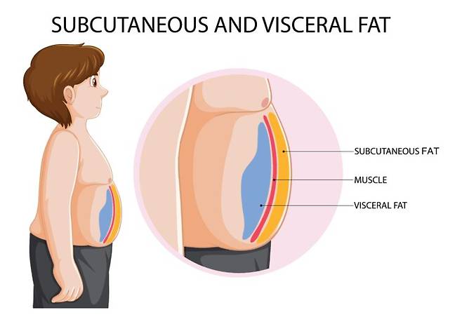 피부 아래 지방(피하지방, subcutaneous fat)과 장기 주변에 쌓이는 지방(내장지방, visceral fat)의 위치를 보여주는 그림. 쌓이는 위치에 따라 건강 영향이 달라진다. 사진=게티이미지뱅크