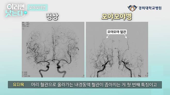 /조선일보 의학·건강 유튜브 '이러면 낫는다'