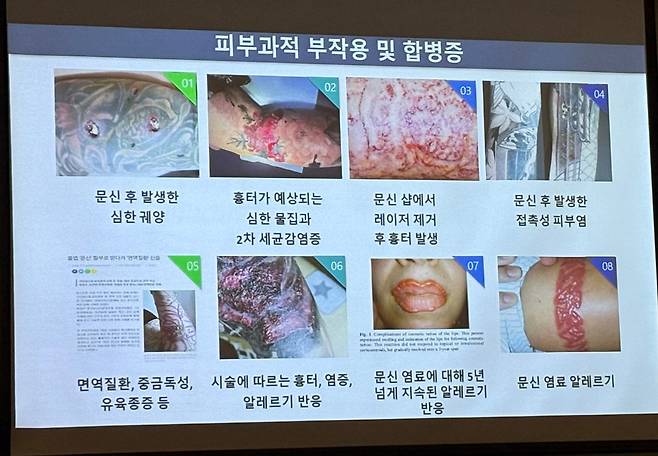 문신은 다양한 의학적 합병증을 유발할 수 있다./사진=신소영 기자
