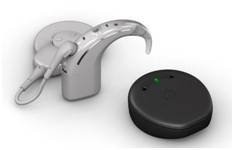 인공와우 외부장치(어음처리기, 귀걸이형, 일체형) [호주 청각전문기업 코클리어 제공]