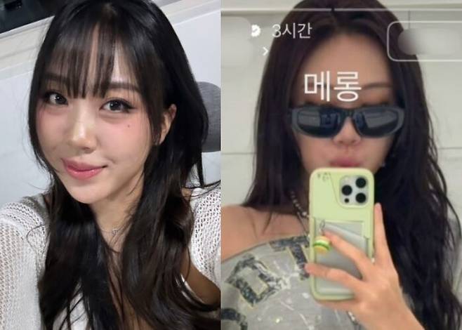 이영지가 눈 밑 지방 재배치 수술을 받았다고 말했다. 사진=이영지 인스타그램