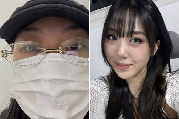 래퍼 이영지가 눈밑지방재배치 수술을 했다고 고백했다. 이영지 인스타그램 캡처