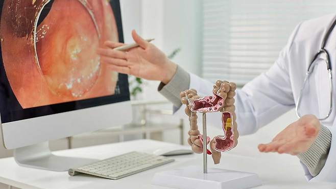 대장암 예방을 위한 대장 내시경 검사는 언제 받는 것이 좋을까｜출처: 클립아트코리아