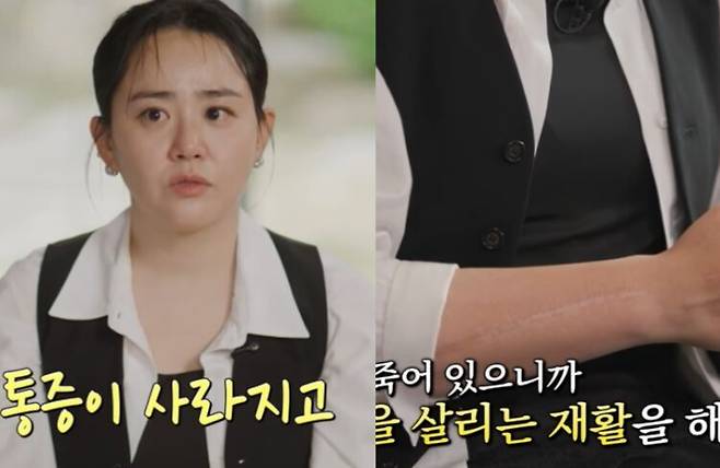 문근영이 급성구획증후군을 앓았던 당시를 회상했다. 오른쪽 사진은 문근영 팔에 남아 있는 흉터. 사진=tvN '유 퀴즈 온더 블록'