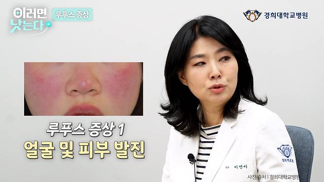 /조선일보 의학·건강 유튜브 '이러면 낫는다'