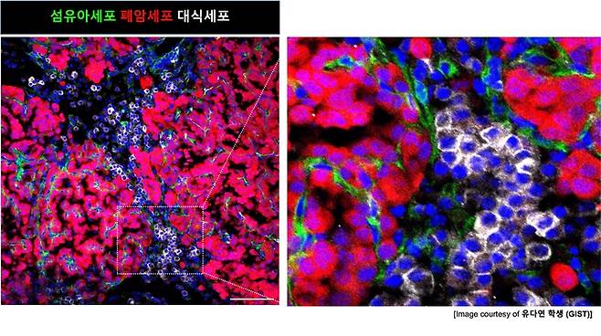 초기 폐암에서 돌연변이 줄기세포가 주변 환경을 바꾸는 과정도. [사진=GIST]