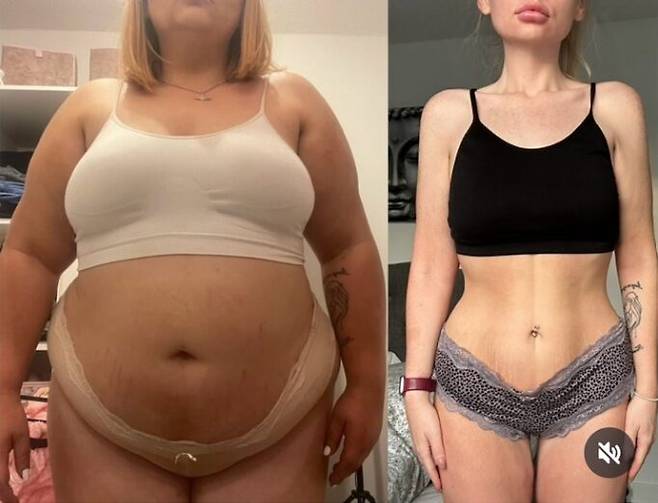 서머 토마스(28)의 70kg 감량 전후 모습. 사진=서머 토마스 SNS