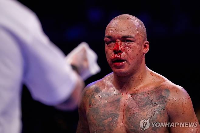 얼굴이 피로 물든 파비오 워들리 [AP=연합뉴스]