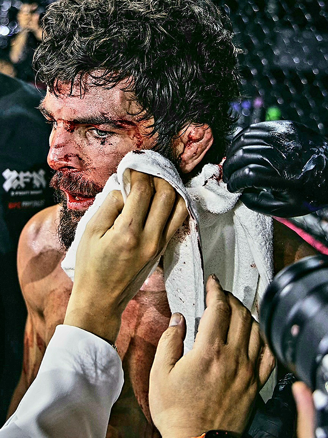 빅리그 10경기 앨릭스 에런 펄리지가 2026년 5월 서울올림픽핸드볼경기장 Z-Fight Night 04 메인이벤트 도중 Contender Series 황인수에게 맞아 생긴 상처를 확인받고 있다. ‘코리안 좀비’ 정찬성 대표의 ZFN은 UFC Fight Pass를 통해 중남미 제외 생중계된다. 사진=MCP ECC