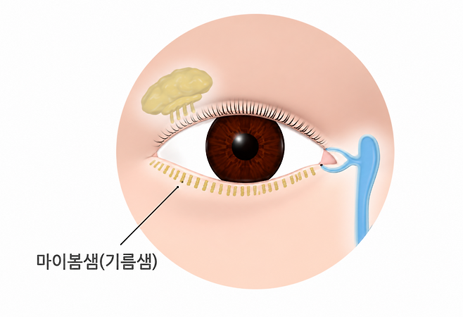 기사의 내용을 바탕으로 생성한 이미지. 챗GPT