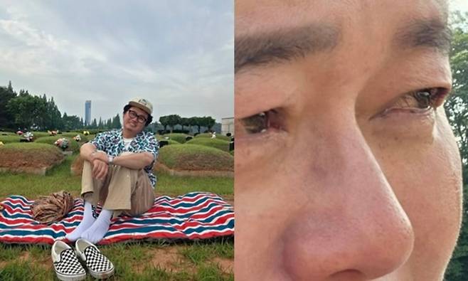 Comedian Yoon Taek Yoon revealed his desperate longing for his deceased parents.On February 2, Yoon shared a picture of his parents on oxygen on his account.After both of them passed away, I sometimes feel like I have nowhere to lean on when things get tough, he said, adding, I miss my dad and mom so much, and I also feel sorry for them.Yoon Taek said, Nothing is permanent in the world. Nothing in the world is forever, not my parents, not my health, not my happiness, and not my current unhappiness. I want you to tell your loved ones you love them more when they are around, hug them, express them, and be with them. Because one day we will only see each other in longing. He also left a warm message. Finally, he posted a photo of himself breaking down in tears, saying, Im crying again, leaving viewers heartbroken.Appearing on tvNs You Quiz on the Block, which aired on the 25th of the same month, he revealed for the first time that his father was battling hepatobiliary cancer, saying, I dont have much time left. Every time I see him, its so hard and its hard to hold back the tears, he said, causing heartbreak. He broke down, saying, Nothing lasts forever, and he wants to go in peace, but theres nothing I can do about it.I think I am a Natural Person was the happiest moment in my fathers life, Yoon Taek recalled, and when he would go to restaurants, he would smile the brightest when he would boast that Yoon Taek is my son.