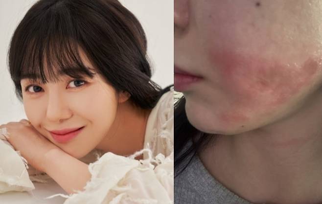 권민아 소셜미디어