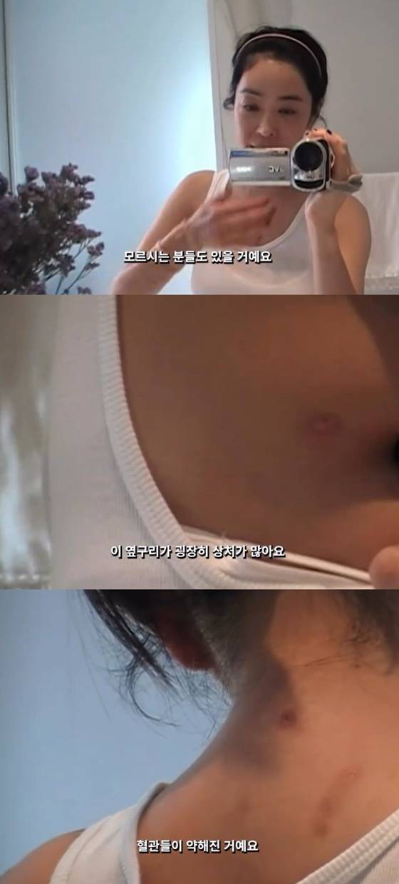 /사진=이혜영 SNS