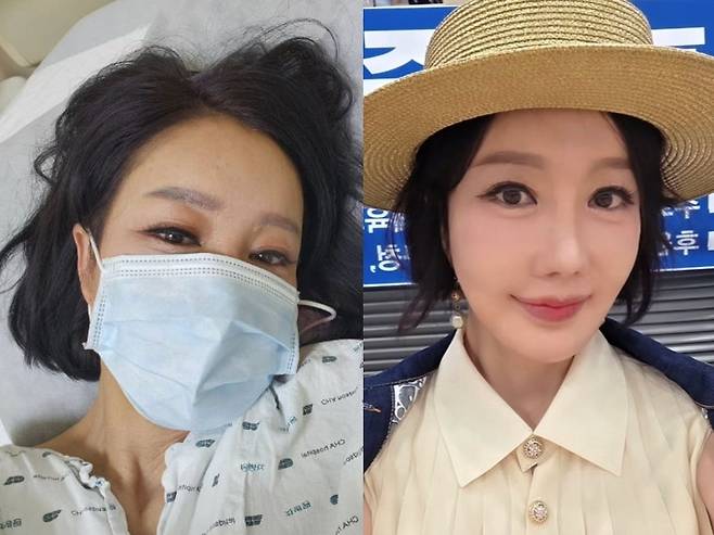 노현희가 고속도로에서 의식을 잃고 응급실로 이송됐을 당시 공개한 사진(왼쪽)과 근황 사진. 노현희 SNS 캡처