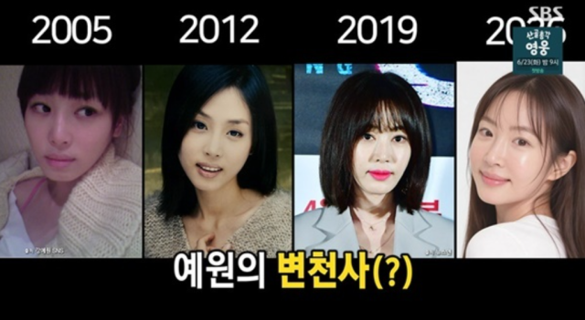 배우 강예원이 총 7번의 성형 수술을 받았던 파란만장한 과거를 쿨하게 인정했다. / SBS ‘미운 우리 새끼’