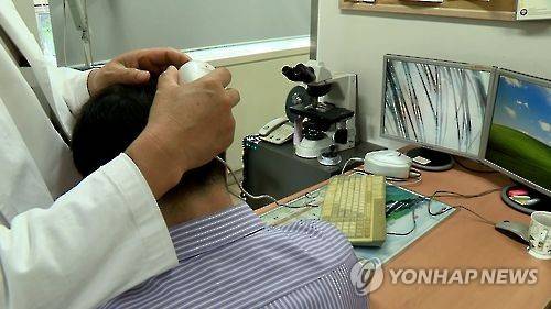 남성 탈모 치료 [연합뉴스TV 캡처]
