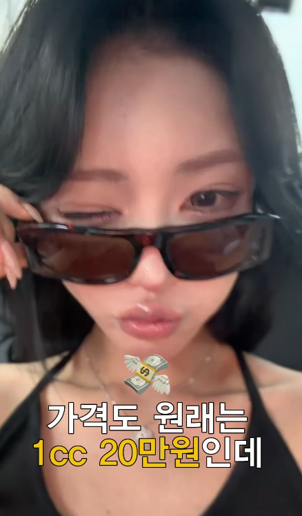 Choi Jun-hee revealed on her social media that she has been getting lip fillers since she was 18 and posted a related video. She has always been open about her plastic surgery and cosmetic procedures, and this time, too, she showed her unfiltered side by introducing the products used in detail.Regarding the released video, netizens have responded with a mix of positive comments praising her confident attitude and concerns about the frequency of her procedures. Choi Jun-hee has consistently disclosed her past cosmetic surgeries, including double eyelid surgery, rhinoplasty, and facial contouring.Choi Jun-hee, who maintains her weight through rigorous self-care, has recently garnered significant public attention after announcing her engagement. Her candid sharing of daily life consistently sparks buzz and continues to draw widespread attention.