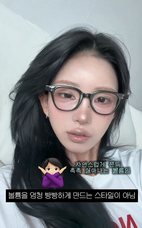 Choi Jun-hee revealed on her social media that she has been getting lip fillers since she was 18 and posted a related video. She has always been open about her plastic surgery and cosmetic procedures, and this time, too, she showed her unfiltered side by introducing the products used in detail.Regarding the released video, netizens have responded with a mix of positive comments praising her confident attitude and concerns about the frequency of her procedures. Choi Jun-hee has consistently disclosed her past cosmetic surgeries, including double eyelid surgery, rhinoplasty, and facial contouring.Choi Jun-hee, who maintains her weight through rigorous self-care, has recently garnered significant public attention after announcing her engagement. Her candid sharing of daily life consistently sparks buzz and continues to draw widespread attention.