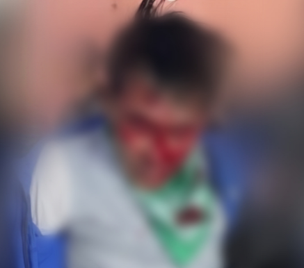 지난 13일 인천 남동구 구월동 복합상가에서 흉기 난동을 벌인 A(59) 씨. 시민들에게 제압된 후 경찰에 체포된 사진. 의자 등에 맞아 얼굴에서 피를 흘리고 있다. [SNS]