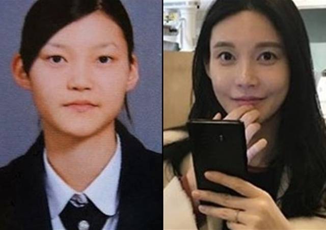 사진 | 온라인커뮤니티
