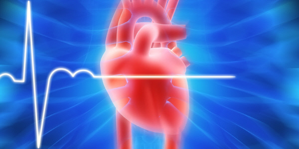심장의 부정맥 현상을 표현한 그래픽 사진. 유성선병원 제공