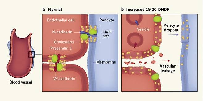 망막에 산소와 영양을 공급하는 모세혈관의 벽은 내피세포(endothelial cell)와 이를 지지하는 주위세포(pericyte)로 이뤄져 있다(왼쪽). 정상 생쥐에서는 내피세포 사이와 내피세포와 주위세포가 지질뗏목(lipid raft)라는 구조에 의해 고정돼 있다(가운데). 그런데 당뇨병 모델 생쥐의 경우 DHA의 대사산물 가운데 하나인 19,20-DHDP의 농도가 높아져 지질뗏목 구조가 해체돼 주위세포가 떨어져 나가고 내피세포 사이가 벌어져 혈장이 샌다. 그 결과 당뇨망막병증으로 이어진다(오른쪽). - 네이처 제공