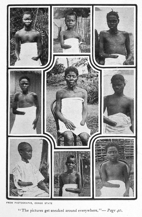 손목이 잘려나간 콩고인들의 모습은 레오폴드2세의 잔혹성을 상징하는 이미지가 됐다.