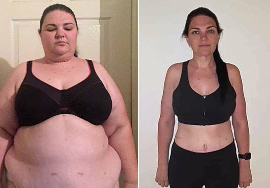 혹독한 다이어트로 90kg 감량에 성공한 호주 여성