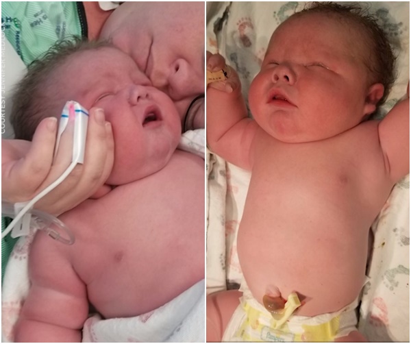 텍사스의 한 병원에서 7킬로그램에 육박하는 신생아가 태어났다.