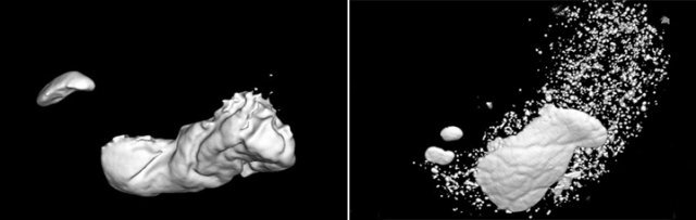 식사 전(왼쪽), 후 (오른쪽) 입체 CT 사진