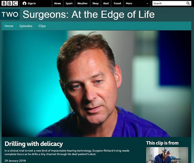 2018년 1월29일 올라온 BBC 다큐멘터리 영상. 청력개선 수술 방법을 소개하는 내용인데, 이 영상의 캡처사진이 인터넷 게시물에서 알츠하이머 관련 영상 사진으로 둔갑했다. ⓒ BBC 캡처