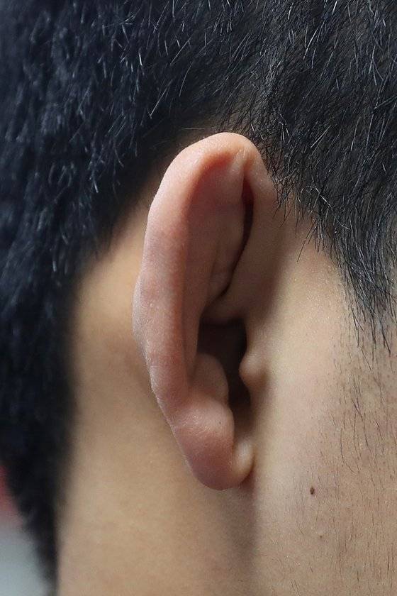 상대방에게 파고드는 '밑씨름' 스타일 탓에 손희찬 선수의 귀는 울퉁불퉁하게 변형됐다. 그는 이렇게 되버린 '만두귀'를 훈장처럼 여긴다고 했다. 장진영 기자