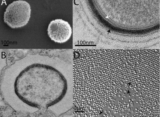 시베리아 영구동토층이 녹으면서 발견된 3만년 전의 고대 바이러스. [Phys.org)