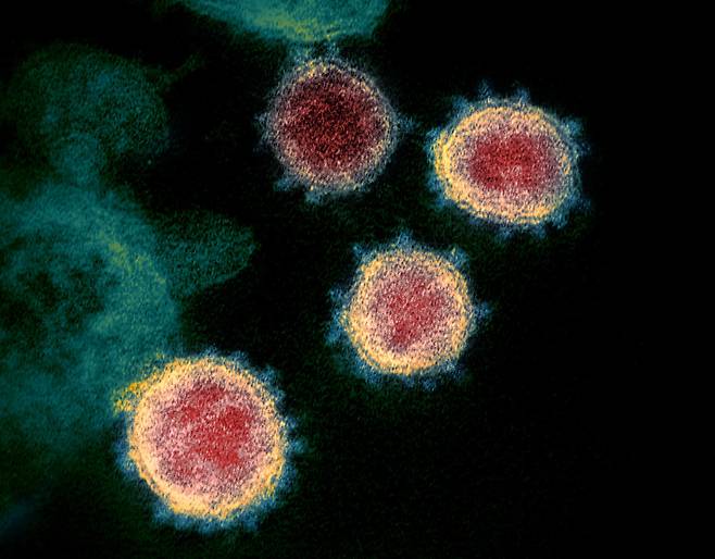 신종 코로나바이러스(2019-nCoV) 전자현미경 촬영 사진 © 미국 국립 알레르기·전염병 연구소 로키마운틴 실험실 (NIAID-RML)