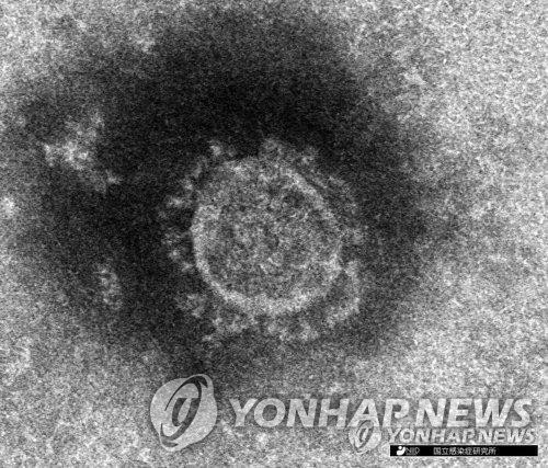 신종 코로나바이러스의 전자현미경 사진 [일본 국립감염증연구소 제공, 재판매 및 DB 금지]