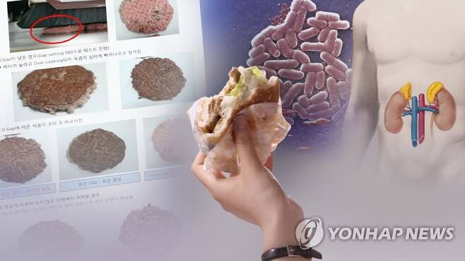 신장 망가뜨리는 '햄버거병' 용혈성요독증후군은?(CG) [연합뉴스TV 제공]