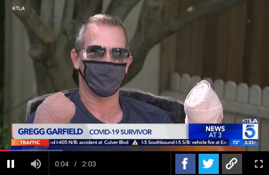 코로나19에서 회복되었지만 손가락을 모두 잃은 미국 남성 그레그 가필드-KTLA영상 갈무리
