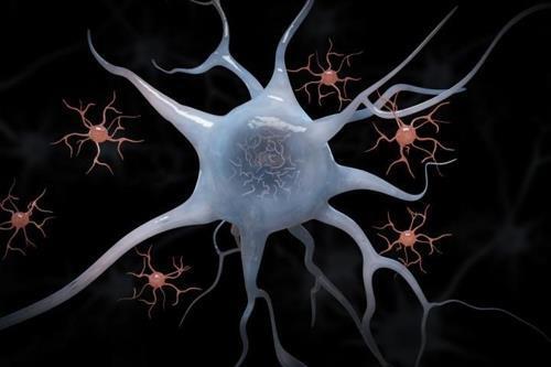 뉴런과 소교세포 타우 단백질의 변형 매듭이 생긴 뉴런을 소교세포가 둘러싸고 있다. (컴퓨터 합성 이미지)  [미 워싱턴대 마크 핼릿 제공 / 재판매 및 DB 금지]